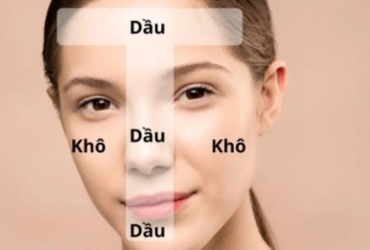 Bạn đã thực hiểu rõ về da hỗ hợp hay chưa