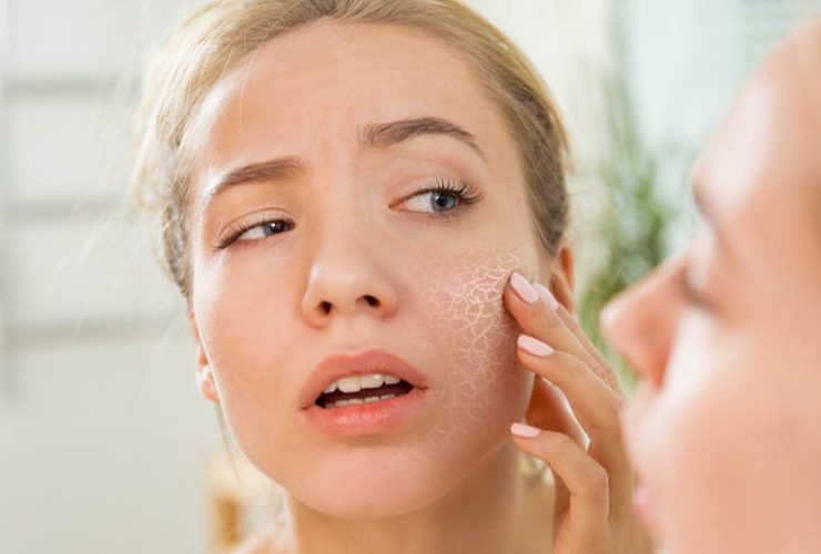 Da khô nứt nẻ ăn gì? Gợi ý bạn 5 thực phẩm giàu vitamin E